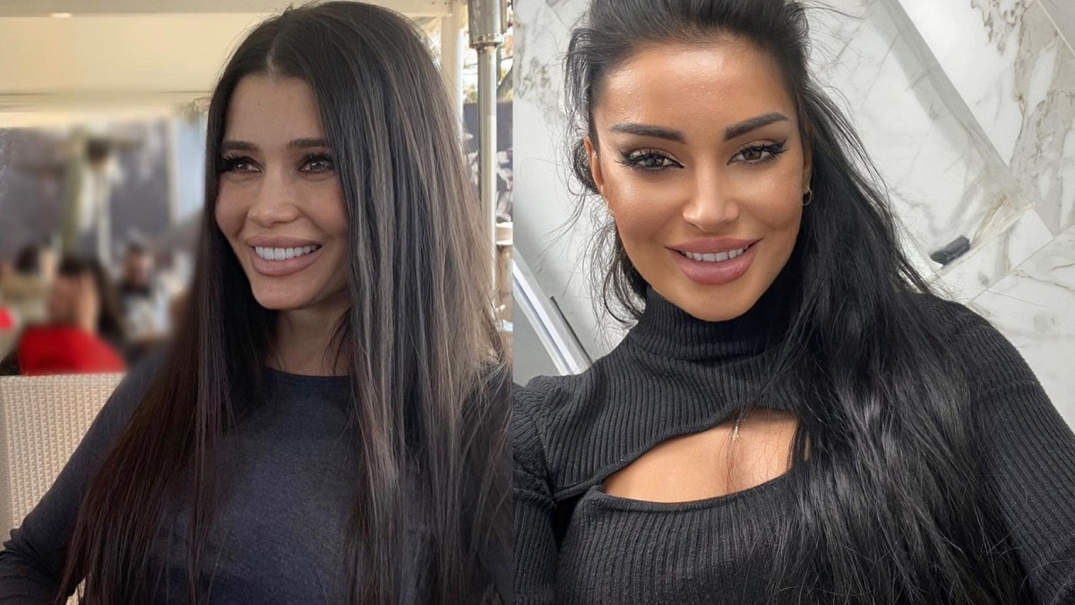 Raluka, Elena Băsescu, Sore sau Elena Ionescu pot în sfârșit să scape de cicatricile post acnee