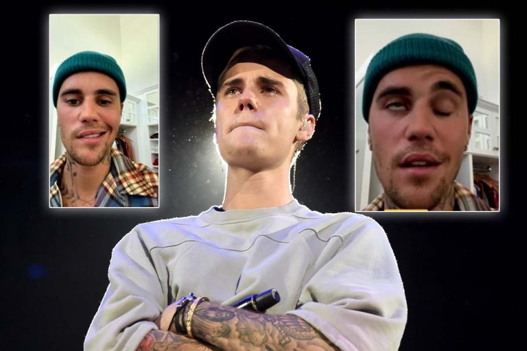 Ramsay Hunt, sindromul de care suferă Justin Bieber. Ce este și cum se poate trata. I-a provocat artistului paralizie facială