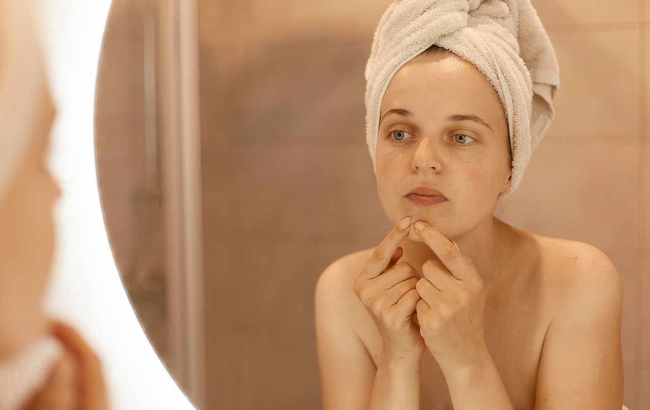 Cum scapi de urmele de pe ten lăsate de coșuri