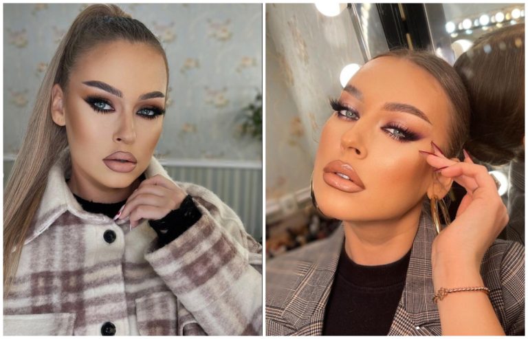 Misha, de nerecunoscut! Ce a pățit la față fosta soție a lui Connect-R. „Câteva zile am arătat horror”