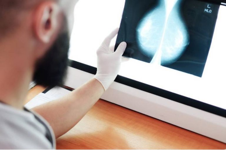 Care este diferența dintre mamografie și ecografie mamară. Ce trebuie să știe femeile despre aceste investigații