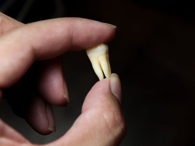 Ce înseamnă când visezi că îți cad dinții