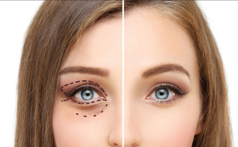 Dr. Iancu Morad ne explică cum putem corecta asimetriile faciale. „Nu cred că o simetrie perfectă este un lucru extraordinar de plăcut” VIDEO EXCLUSIV