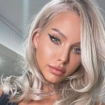 De ce s-a umflat Carmen Grebenișan la față