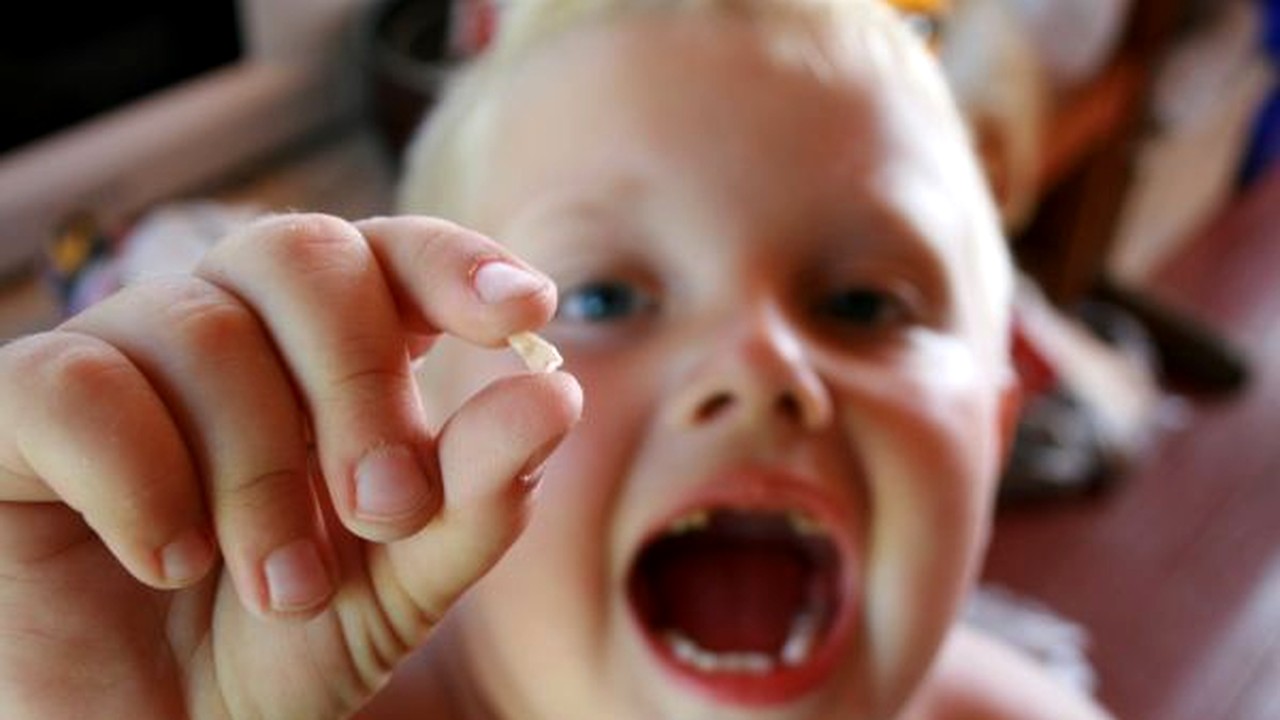 Importanța dinților de lapte și cum pot strica maxilarul unui copil, pe viață