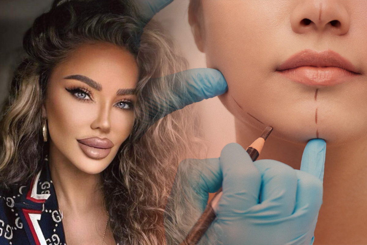 Cum arată Bianca Drăgușanu, după ce și-a făcut o nouă procedură estetică la față. Vedeta nu s-a sfiit să se afișeze așa în fața fanilor