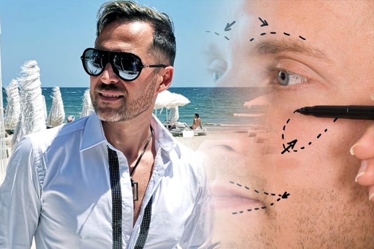 Ce intervenții estetice are Dinu Maxer, la aproape 50 de ani. Cum a întinerit: „10 ani a dat înapoi” VIDEO EXCLUSIV