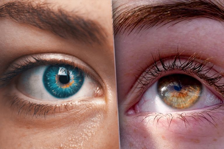 De ce ți se zbate ochiul stâng, de fapt. Toți am crezut altceva până acum