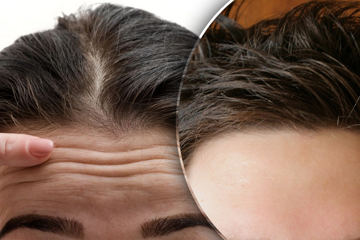 Ce dezvaluie forma fruntii despre personalitatea ta