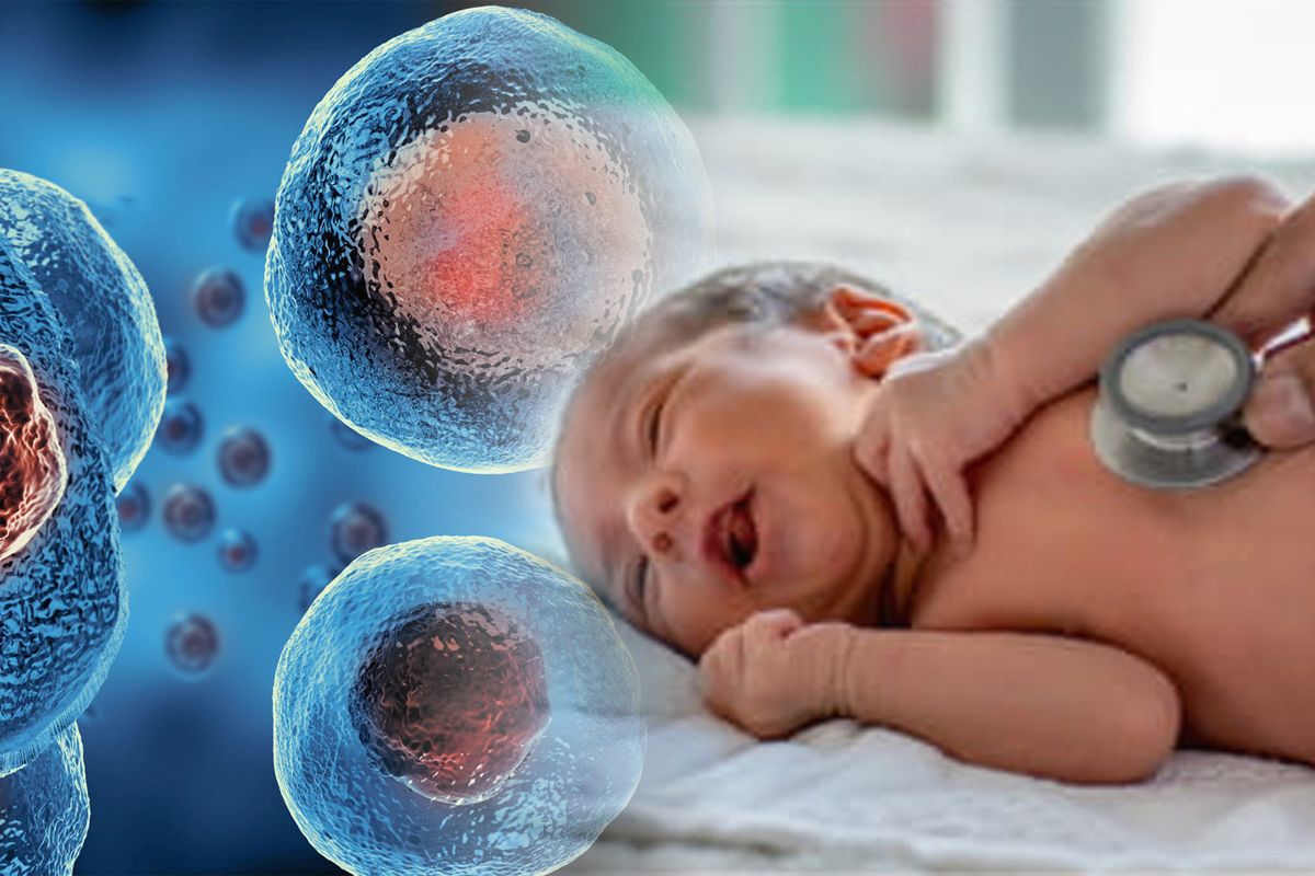 Ce rol au celulele stem în tratarea afecțiunilor pulmonare la copiii născuți prematur