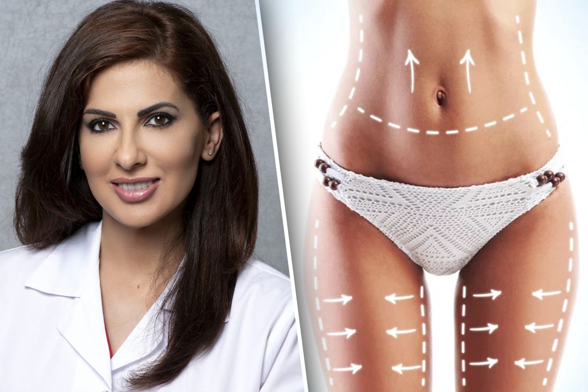 Ce este lipoaspiratia laser, cat dureaza si ce efecte are. Dr. Dana Miricioiu Da rezultate VIDEO EXCLUSIV