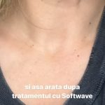 Cum arata Gina Pistol dupa o noua interventie estetica 3