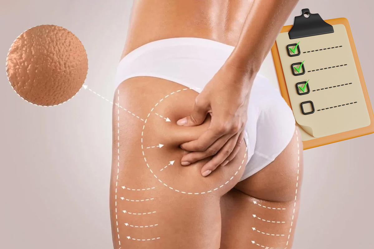 5 obiceiuri zilnice despre care nu stiai ca agraveaza celulita