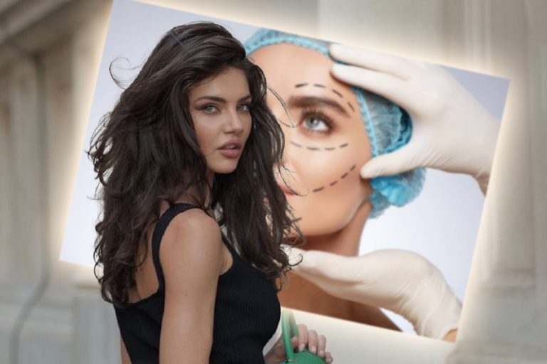 Ce a pățit Cristina Ich, după ultima intervenție estetică: “Ajunsesem să am găuri în față”. A avut mari probleme