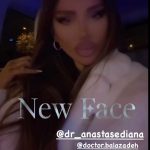 Cum arata Bianca Dragusanu, la 2 saptamani de la interventia de lifting 1