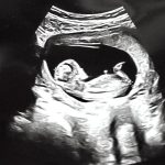 Artista din Romania este gravida in 3 luni