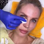 Ce interventie si-a facut Andreea Banică la fata 1