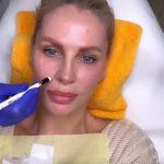 Ce interventie si-a facut Andreea Banică la fata 4