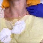 Ce interventie si-a facut Andreea Banică la fata 7