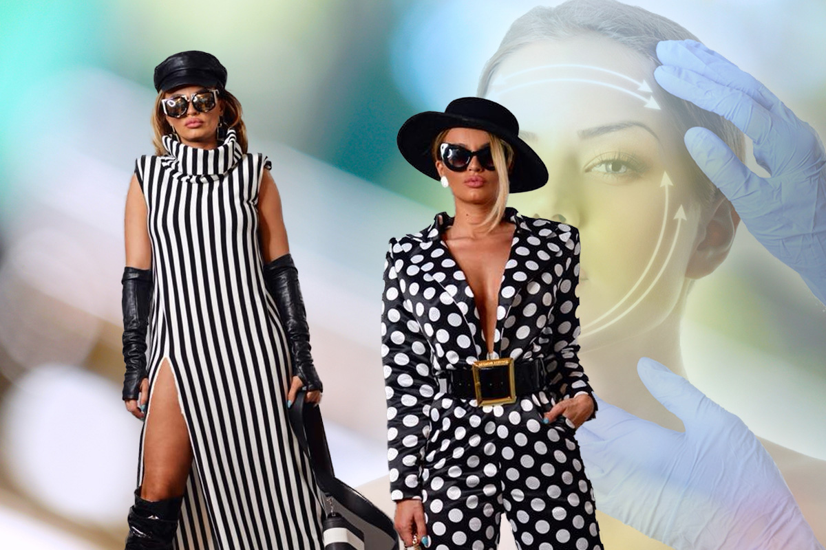 Claudia Iosif, Babs, si-a facut o noua interventie estetica