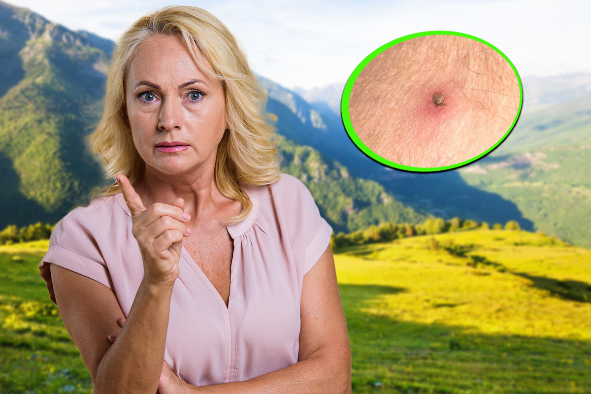 Ce sa faci daca te-a muscat o capusa