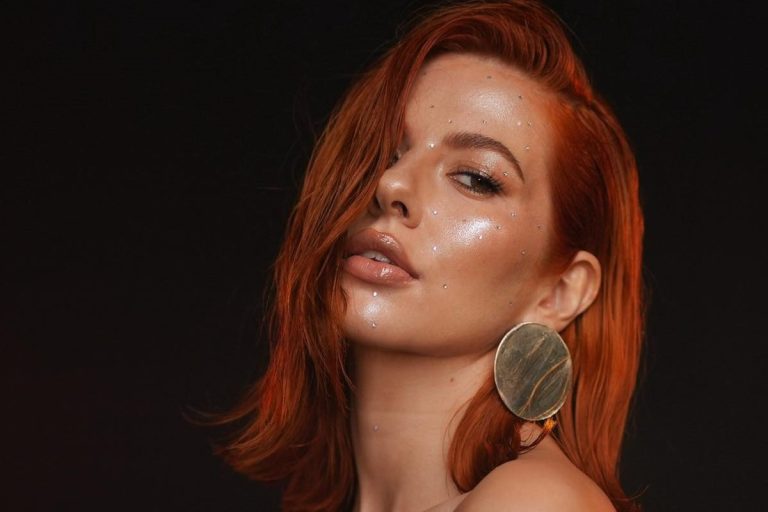 Lidia Buble, bolnavă de psoriazis. ”Pe pielea mea au început să apară niște pete foarte ciudate”