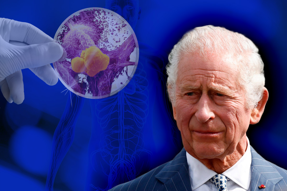 S-a aflat ce fel de cancer ar avea Regele Charles