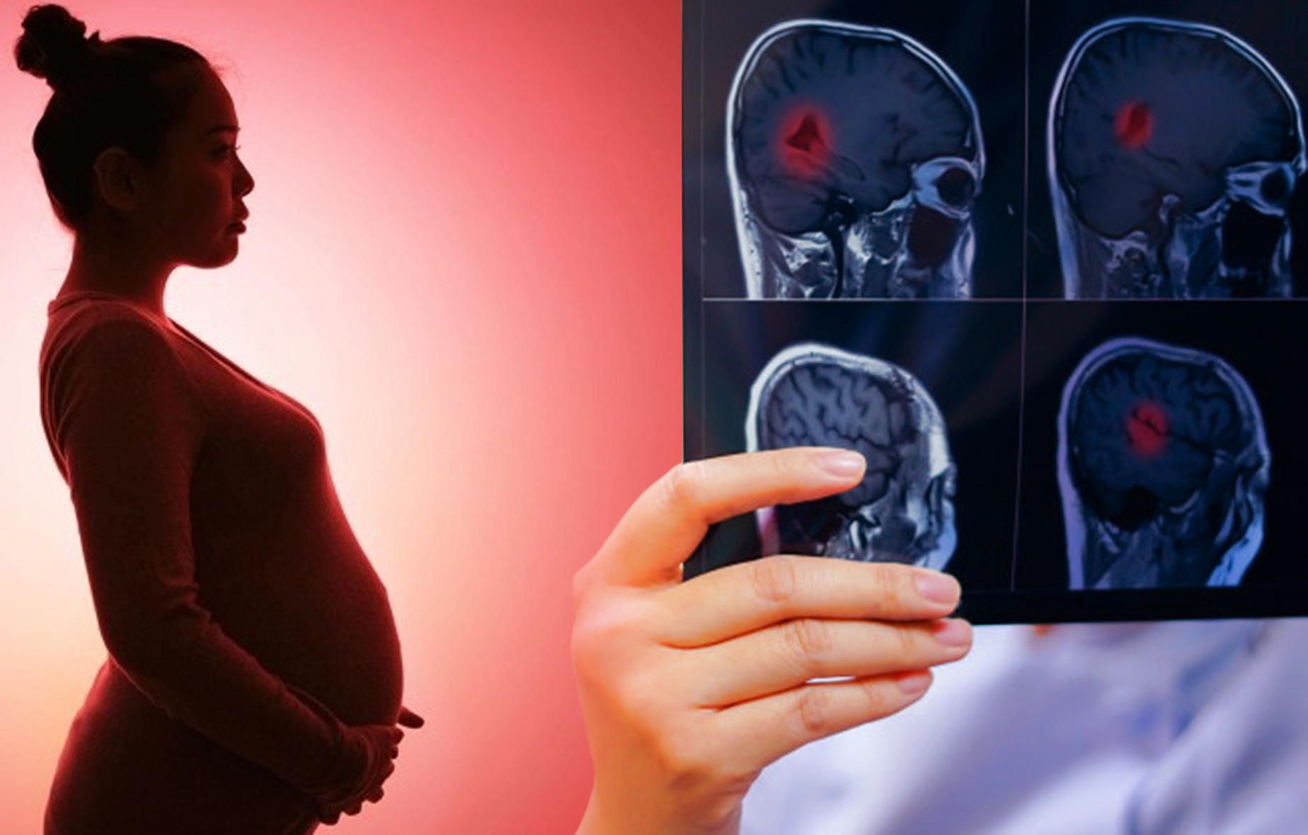 Impactul sarcinii asupra creierului