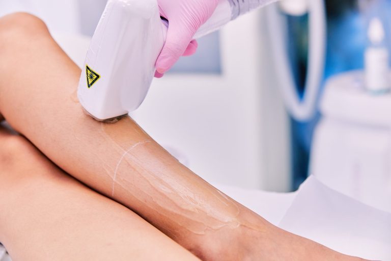 Ce trebuie să faci înainte de o ședință de epilare definitivă. Iată cum trebuie să te pregătești