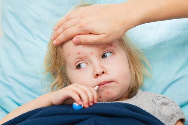 Adevărul despre rujeolă și vaccin. Medicii avertizează asupra complicațiilor grave