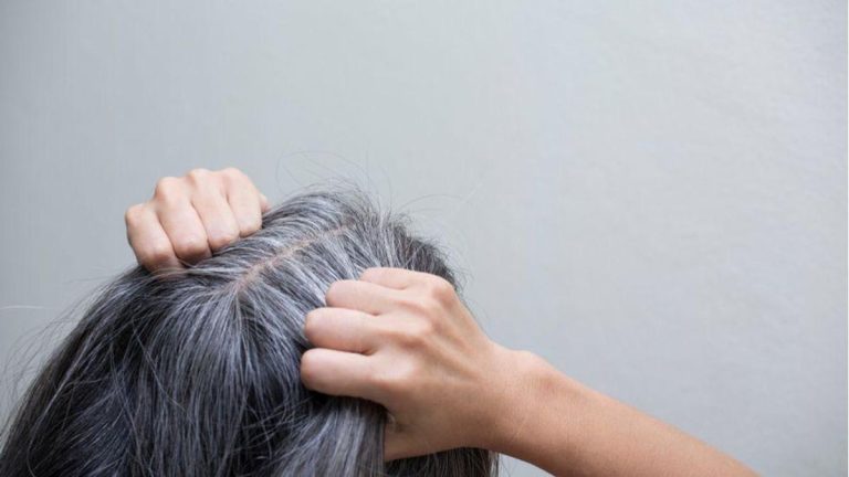 Spune adio firelor albe! Redă-ți culoarea naturală cu doar două ingrediente simple